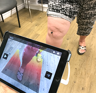 OdrA knee brace 3D scan