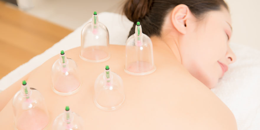 Woman lying facebown on a massage table receiving a dry cupping treatment